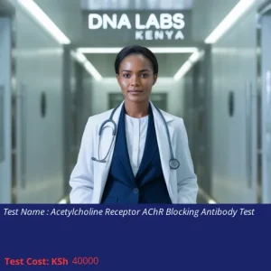 Acetylcholine Receptor AChR Blocking Antibody Test