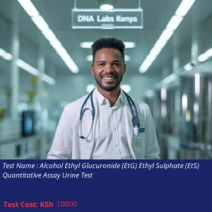Alcohol Ethyl Glucuronide (EtG) Ethyl Sulphate (EtS) Quantitative Assay Urine Test