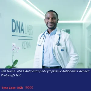 ANCA Antineutrophil Cytoplasmic Antibodies Extended Profile IgG Test