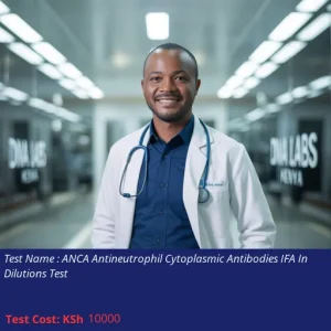 ANCA Antineutrophil Cytoplasmic Antibodies IFA In Dilutions Test