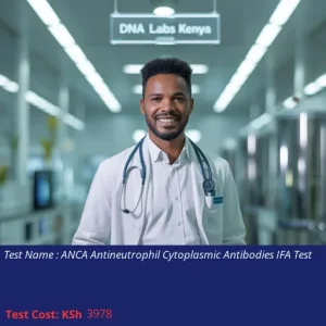 ANCA Antineutrophil Cytoplasmic Antibodies IFA Test