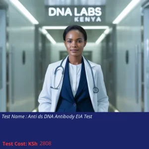 Anti ds DNA Antibody EIA Test