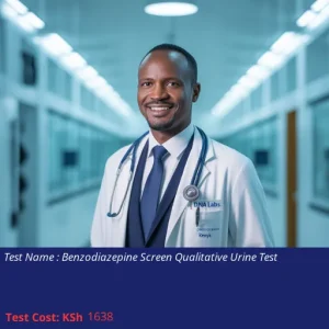 Benzodiazepine Screen Qualitative Urine Test