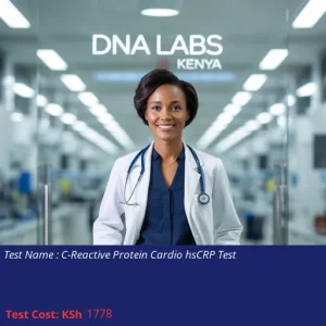 C-Reactive Protein Cardio hsCRP Test