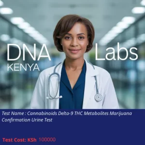 Cannabinoids Delta-9 THC Metabolites Marijuana Confirmation Urine Test