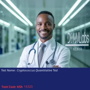Cryptococcus Quantitative Test