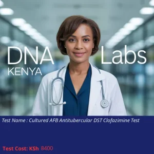Cultured AFB Antitubercular DST Clofazimine Test