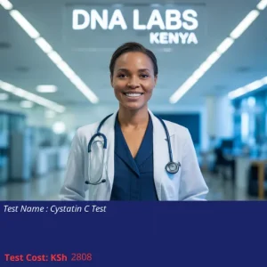 Cystatin C Test