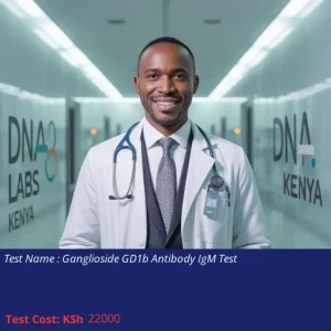 Ganglioside GD1b Antibody IgM Test