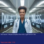 Herpes Simplex Virus HSV 2 IgM Serum Test