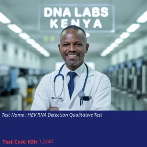 HEV RNA Detection Qualitative Test