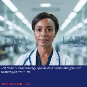 Histopathology Special Stain Phosphotungstic Acid Hematoxylin PTAH Test
