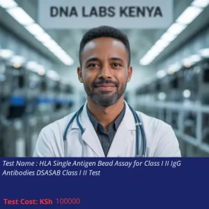 HLA Single Antigen Bead Assay for Class I II IgG Antibodies DSASAB Class I II Test