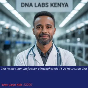 Immunofixation Electrophoresis IFE 24 Hour Urine Test