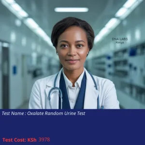 Oxalate Random Urine Test