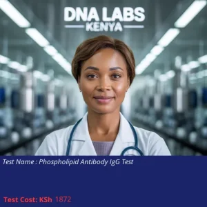 Phospholipid Antibody IgG Test