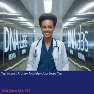 Protein Total Random Urine Test