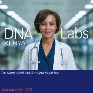 SARS-CoV-2 Antigen Rapid Test