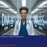SmRNP Antibody Test