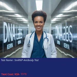 SmRNP Antibody Test