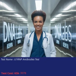 U1RNP Antibodies Test