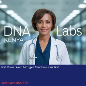 Urea Nitrogen Random Urine Test