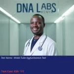 Widal Tube Agglutination Test