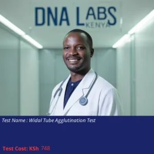 Widal Tube Agglutination Test