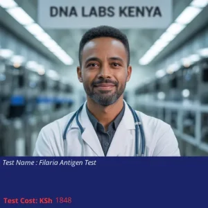 Filaria Antigen Test