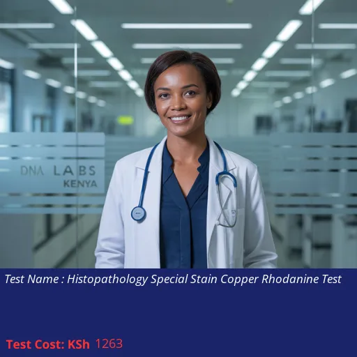 Histopathology Special Stain Copper Rhodanine Test