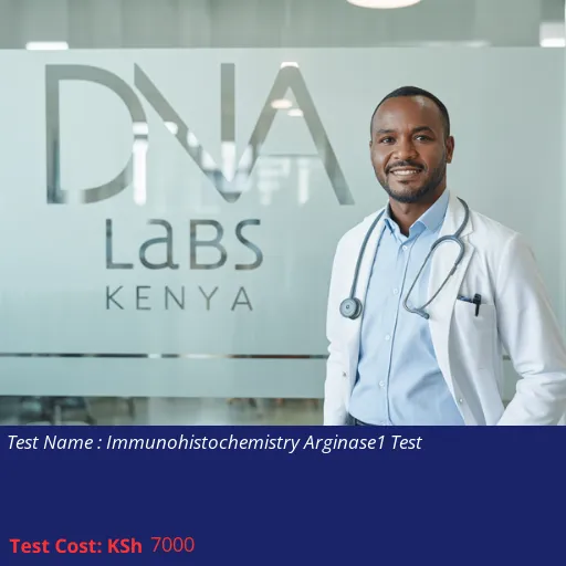 Immunohistochemistry Arginase1 Test