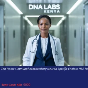 Immunohistochemistry Neuron Specific Enolase NSE Test