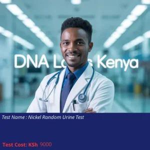 Nickel Random Urine Test