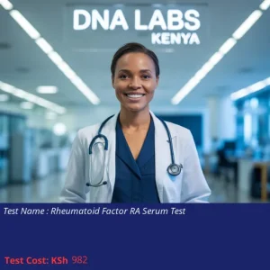 Rheumatoid Factor RA Serum Test