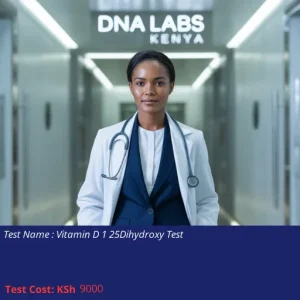 Vitamin D 1 25Dihydroxy Test