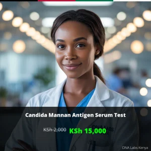 Candida Mannan Antigen Serum Test - Affordable KSh 15000 in Kenya