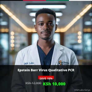 Epstein Barr Virus Qualitative PCR Test - KSh 12
