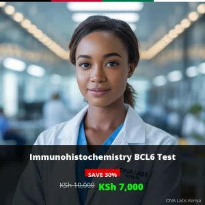 Immunohistochemistry BCL6 Test - Affordable Price in Kenya (KSh 7000)