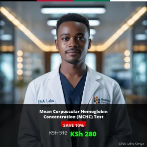 Mean Corpuscular Hemoglobin Concentration (MCHC) Test in Kenya - KSh 280 Discount Price