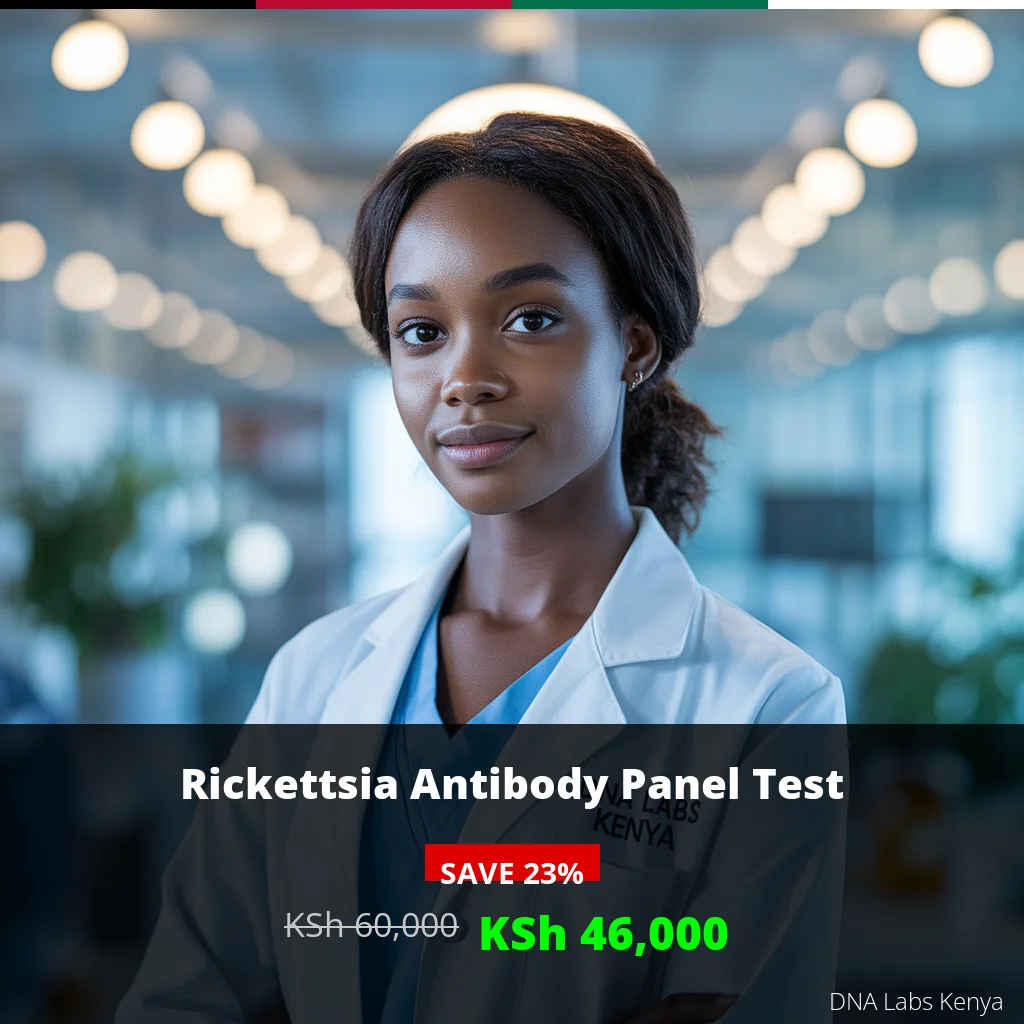 Rickettsia Antibody Panel Test - KSh 60