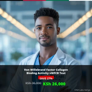 Von Willebrand Factor Collagen Binding Activity vWFCB Test - 26000 KSh in Kenya