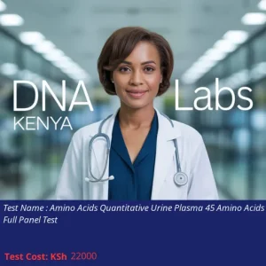 Amino Acids Quantitative Urine Plasma 45 Amino Acids Full Panel Test