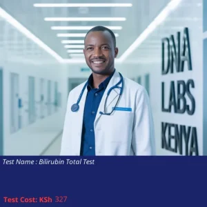 Bilirubin Total Test
