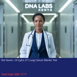 CA Cyfra 211 Lung Cancer Marker Test