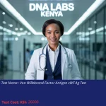 Von Willebrand Factor Antigen vWF Ag Test