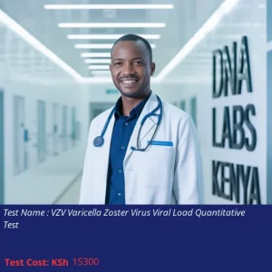 VZV Varicella Zoster Virus Viral Load Quantitative Test