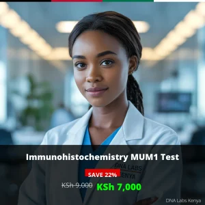 Immunohistochemistry MUM1 Test in Kenya - KSh 7000 Discount Price