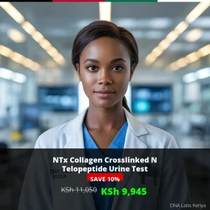 NTx Collagen Crosslinked N Telopeptide Urine Test - KSh 11