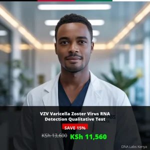 VZV Varicella Zoster Virus RNA Detection Qualitative Test - KSh 13600 in Kenya